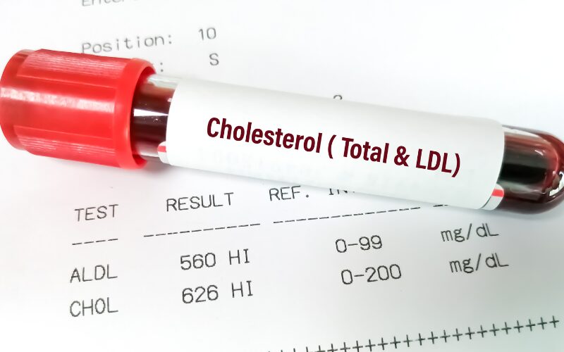 meranie cholesterolu v lekárni