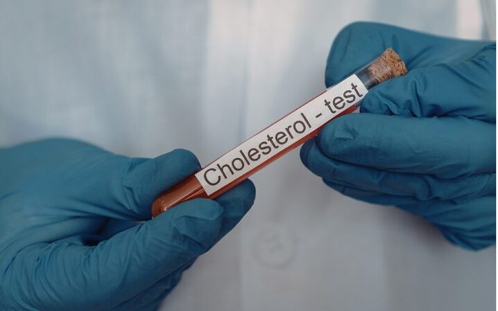 test cholesterol